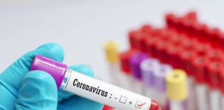 Delhi Government issues directives to reduce price of RT-PCR test in Delhi