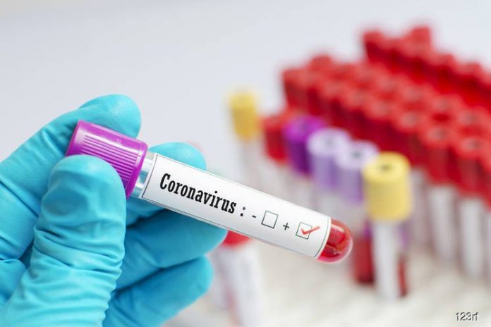 Delhi Government issues directives to reduce price of RT-PCR test in Delhi